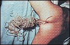 ascaris.jpg