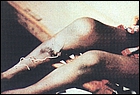 dracunculis.jpg